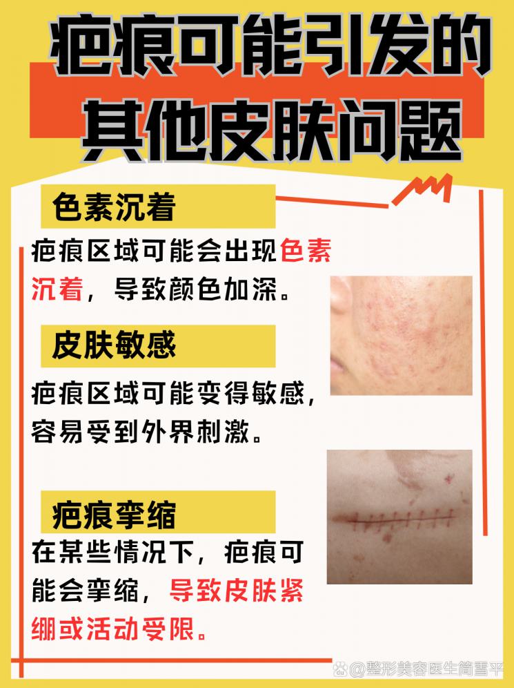 牙齿印变疤痕？疤痕消除全攻略