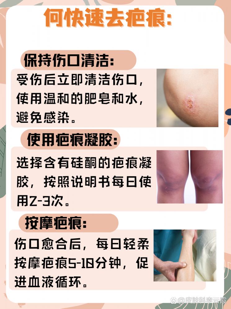 疤痕克星：快速祛疤的居家小妙招