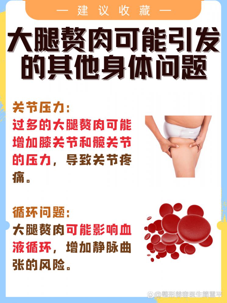 瘦腿秘籍：擊退大腿贅肉的高效策略