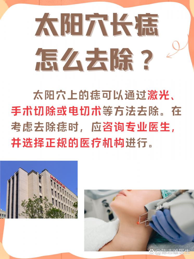 太陽穴長痣？揭秘去除方法！