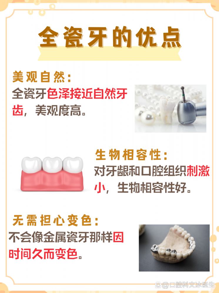 種植全瓷牙多少錢一顆