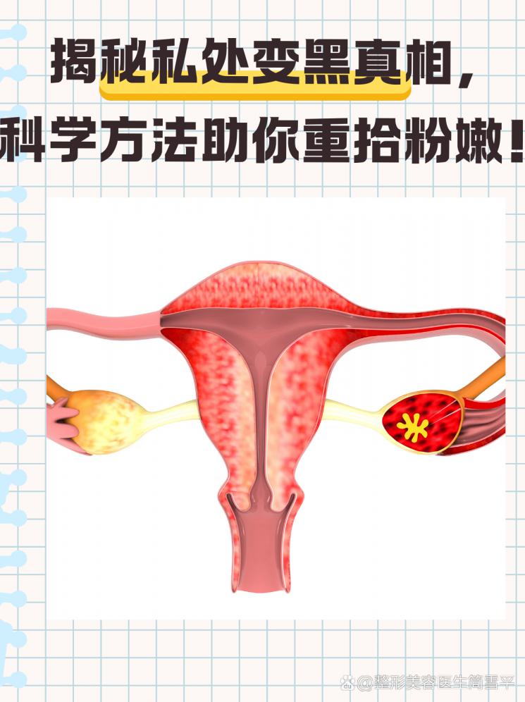 揭秘私處變黑真相，科學(xué)方法助你重拾粉嫩！