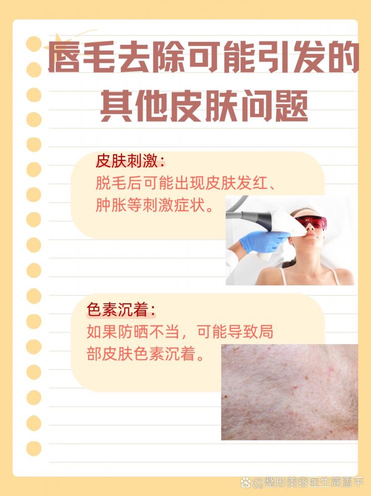 女生告别唇毛：永久去除的秘诀