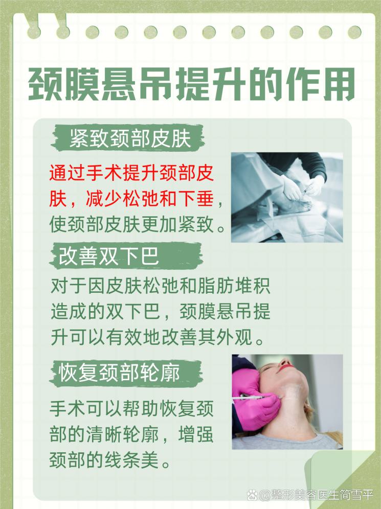 頸膜懸吊提升：揭秘效果維持時間