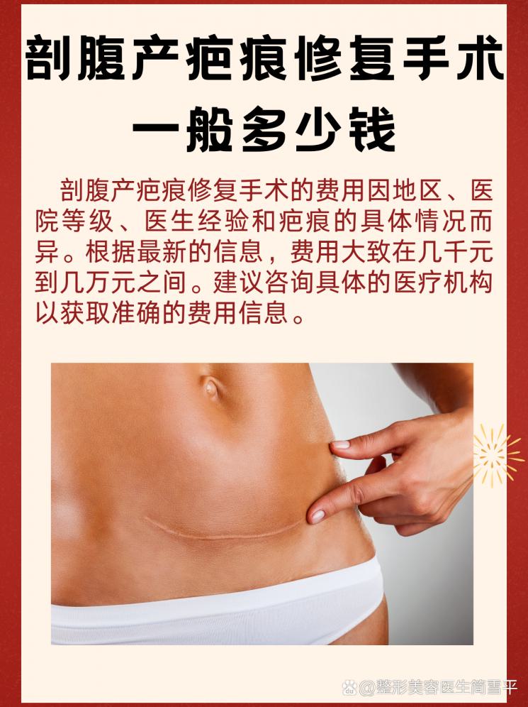 剖腹產(chǎn)疤痕修復(fù)大揭秘！價格大公開