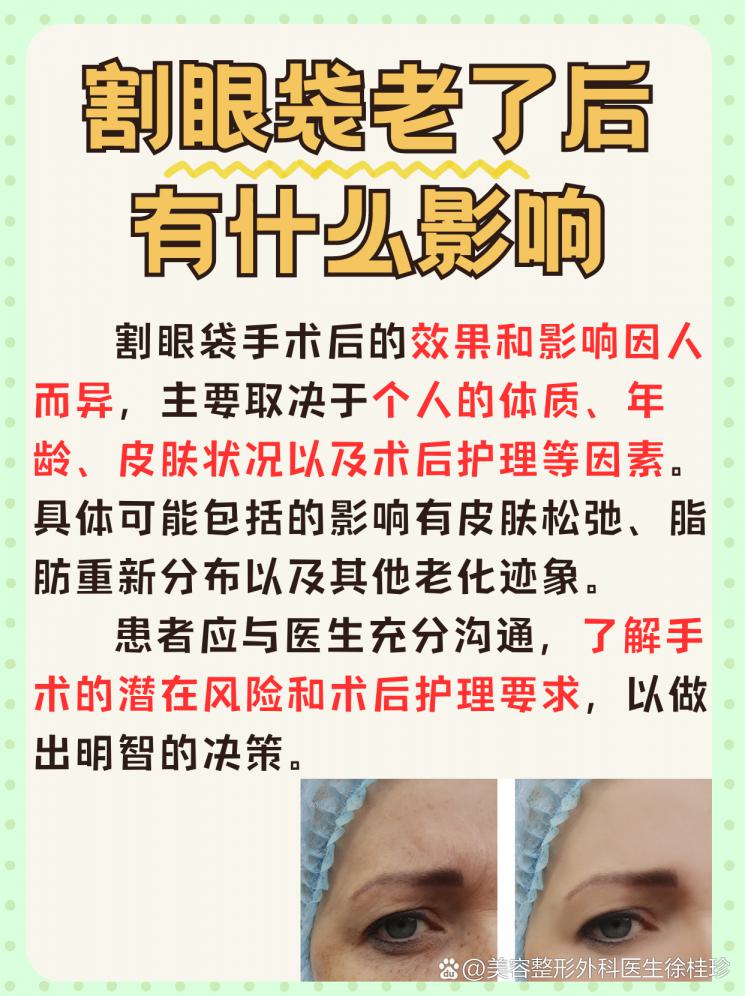 割眼袋，老了后會有什么影響？揭秘你不得不知的事！