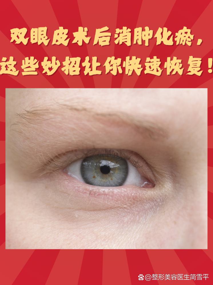 雙眼皮術(shù)后消腫化瘀，這些妙招讓你快速恢復(fù)！