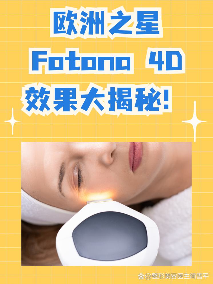 歐洲之星Fotona 4D效果大揭秘！