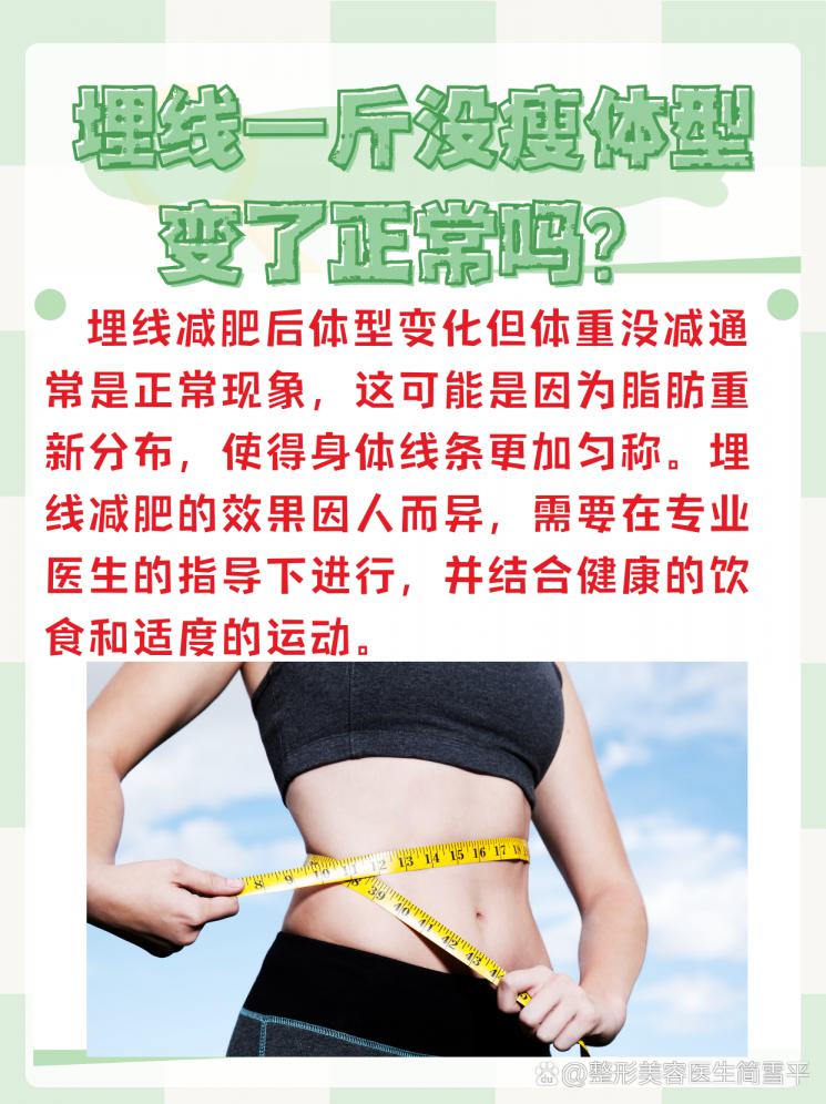 埋線減肥后體型變美，體重沒減？揭秘背后真相！