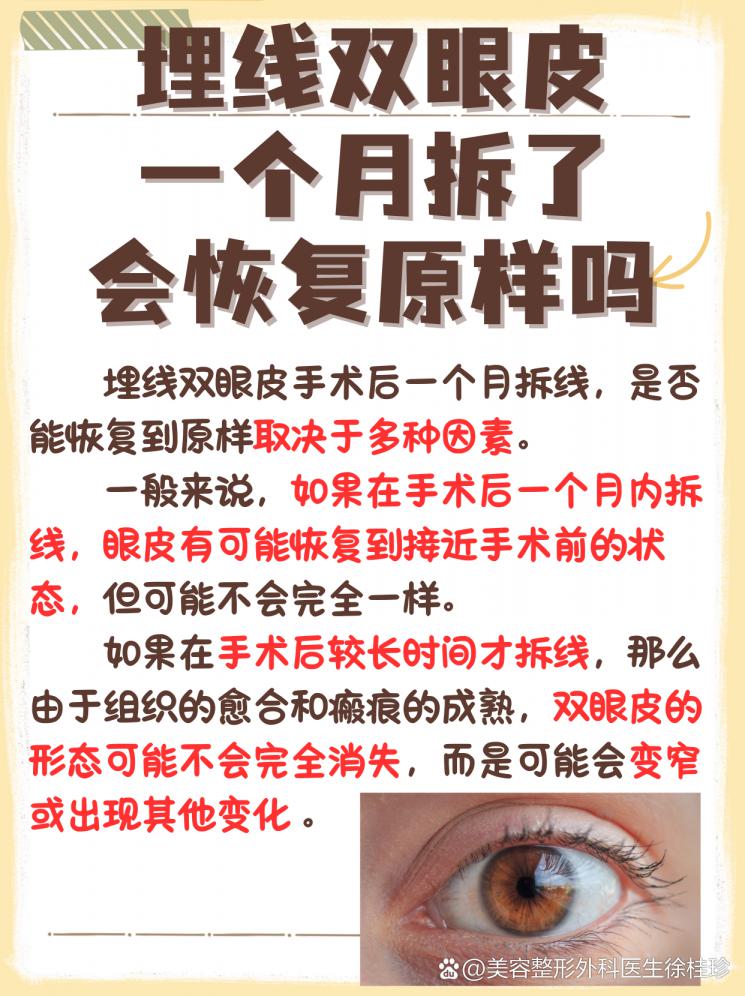 埋线一个月后拆除，能回到从前吗？