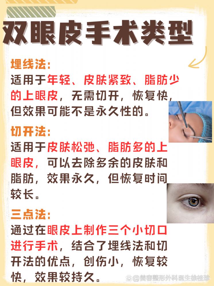 埋线一个月后拆除，能回到从前吗？
