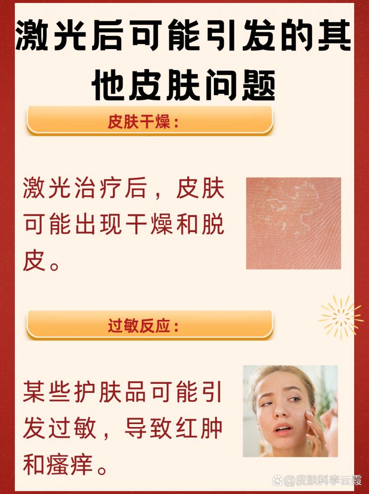 激光术后色沉克星：恢复亮白肌肤