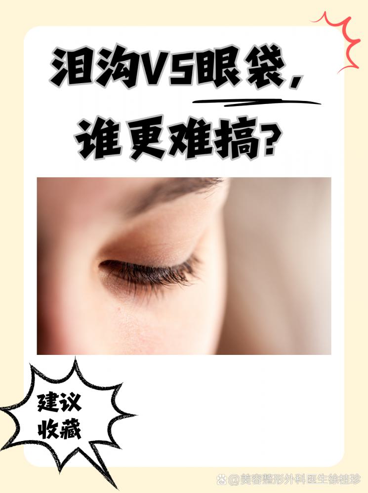 淚溝VS眼袋，誰更難搞？