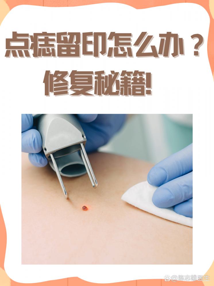 点痣留印怎么办？修复秘籍！