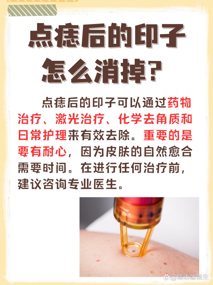 点痣后的印子怎么消？揭秘肌肤恢复的秘诀！