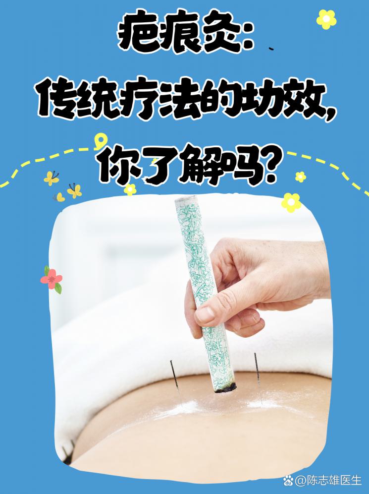 疤痕灸：传统疗法的功效，你了解吗？