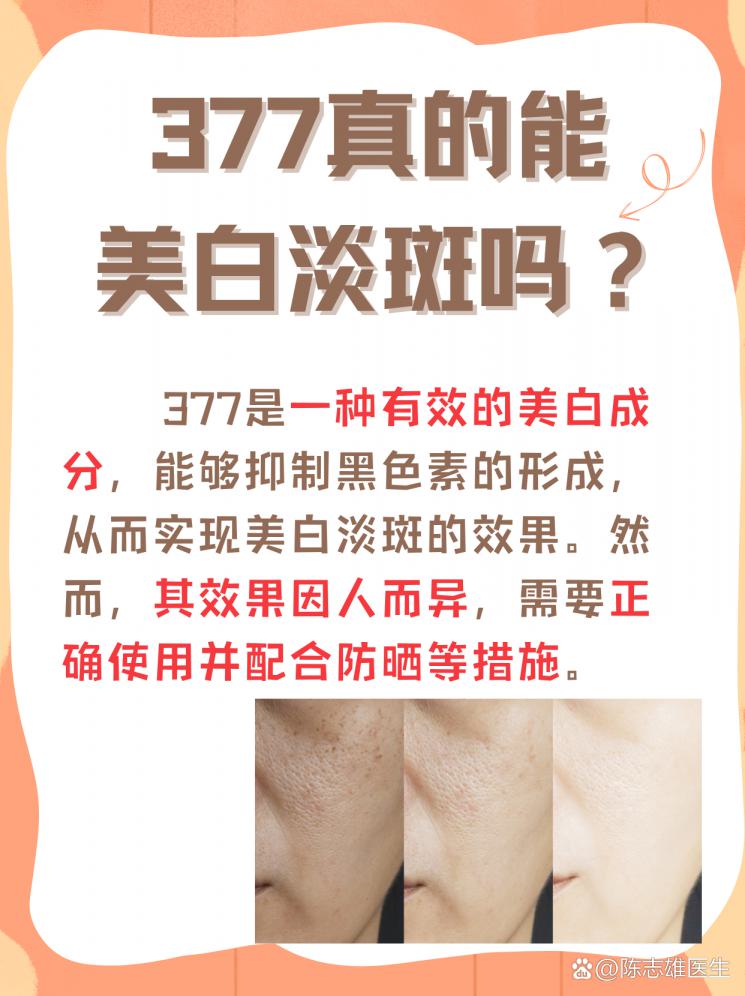 揭秘377：真的能美白淡斑吗？