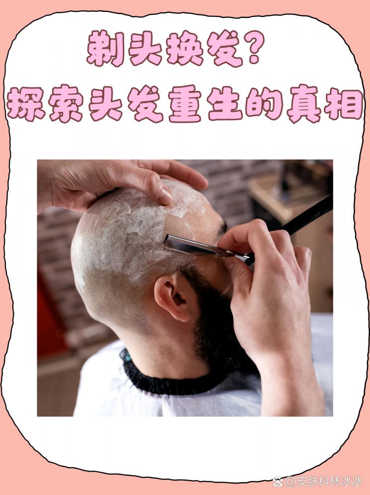 剃头换发？探索头发重生的真相