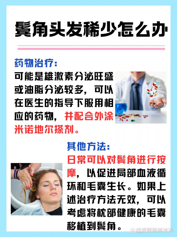 鬓角稀疏不用愁：重拾浓密秀发的秘诀