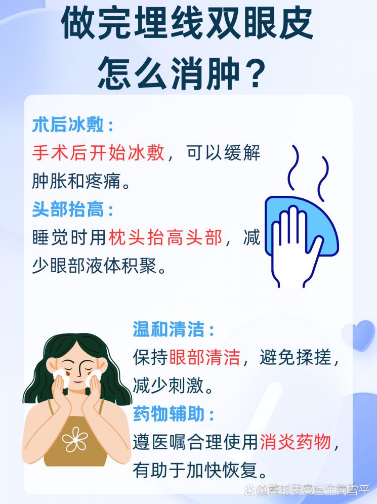 埋线双眼皮术后消肿，快速恢复的秘诀在这里！