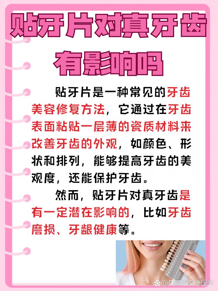 贴牙片，真的对真牙齿友好吗？