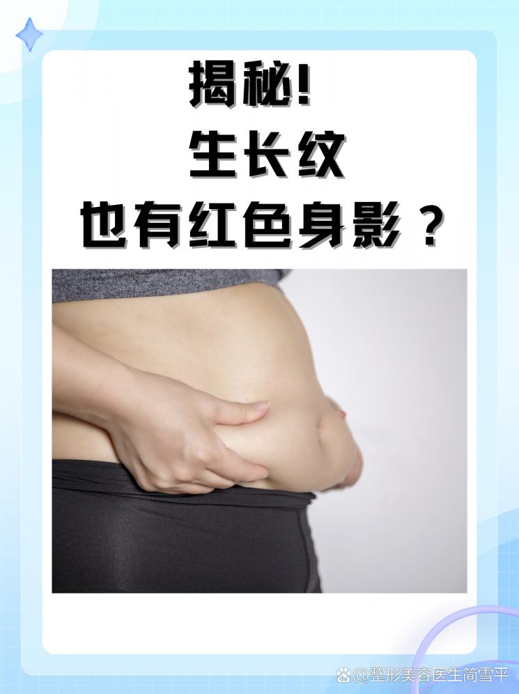 揭秘！生长纹也有红色身影？