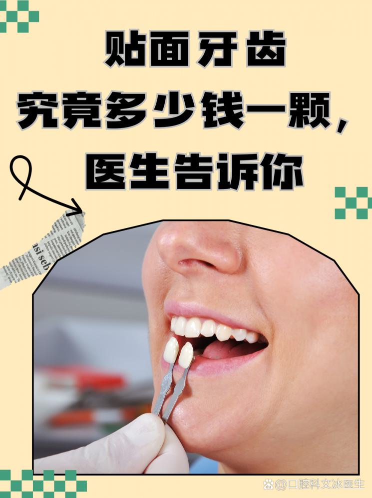 贴面牙齿究竟多少钱一颗，医生告诉你