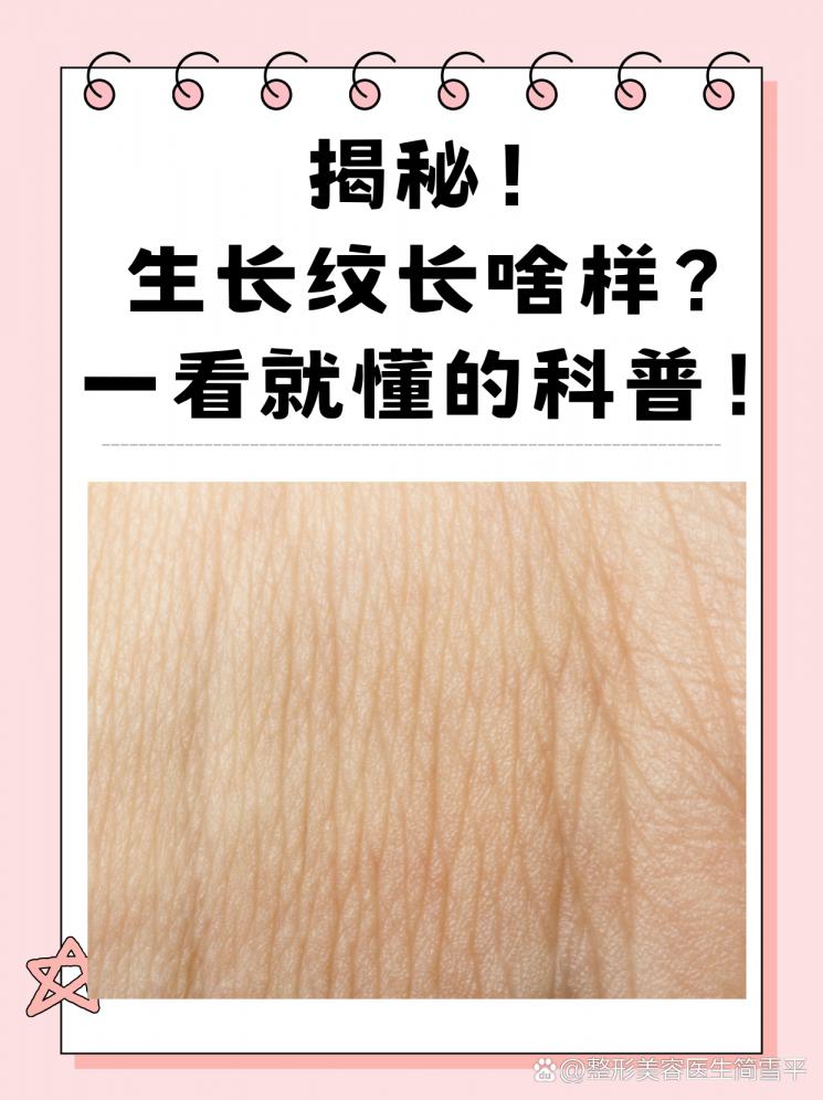 揭秘！生长纹长啥样？一看就懂的科普！