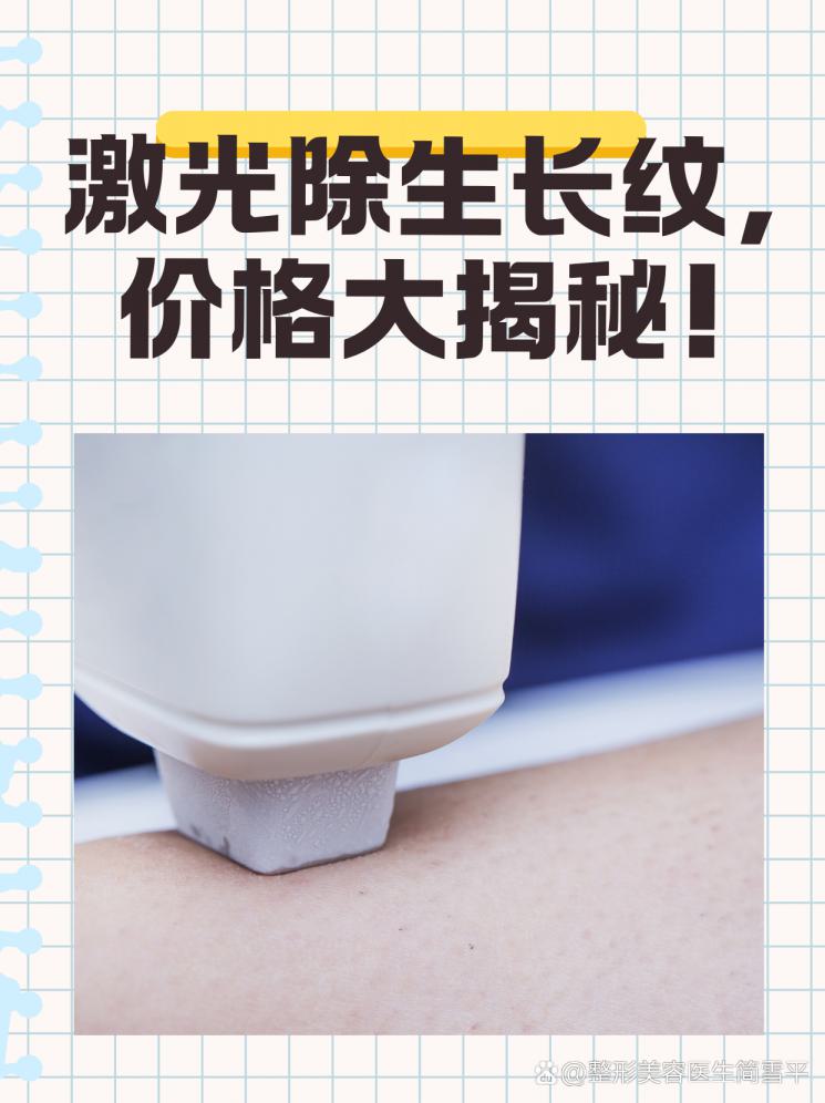 激光除生长纹，价格大揭秘！