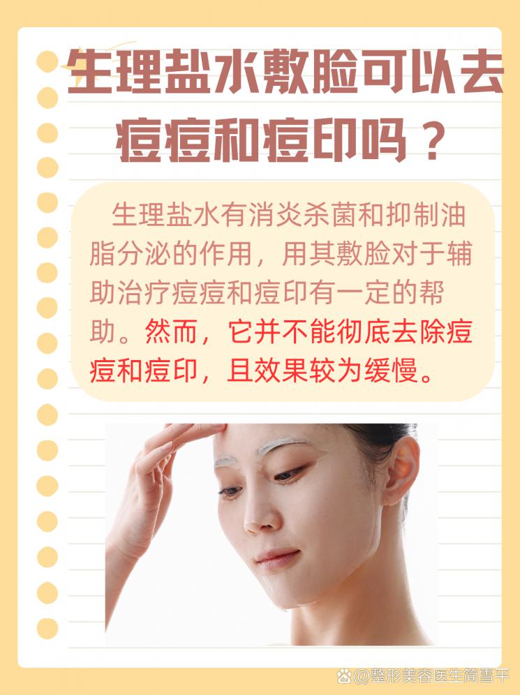 生理盐水敷脸祛痘印吗？真相竟是这样！