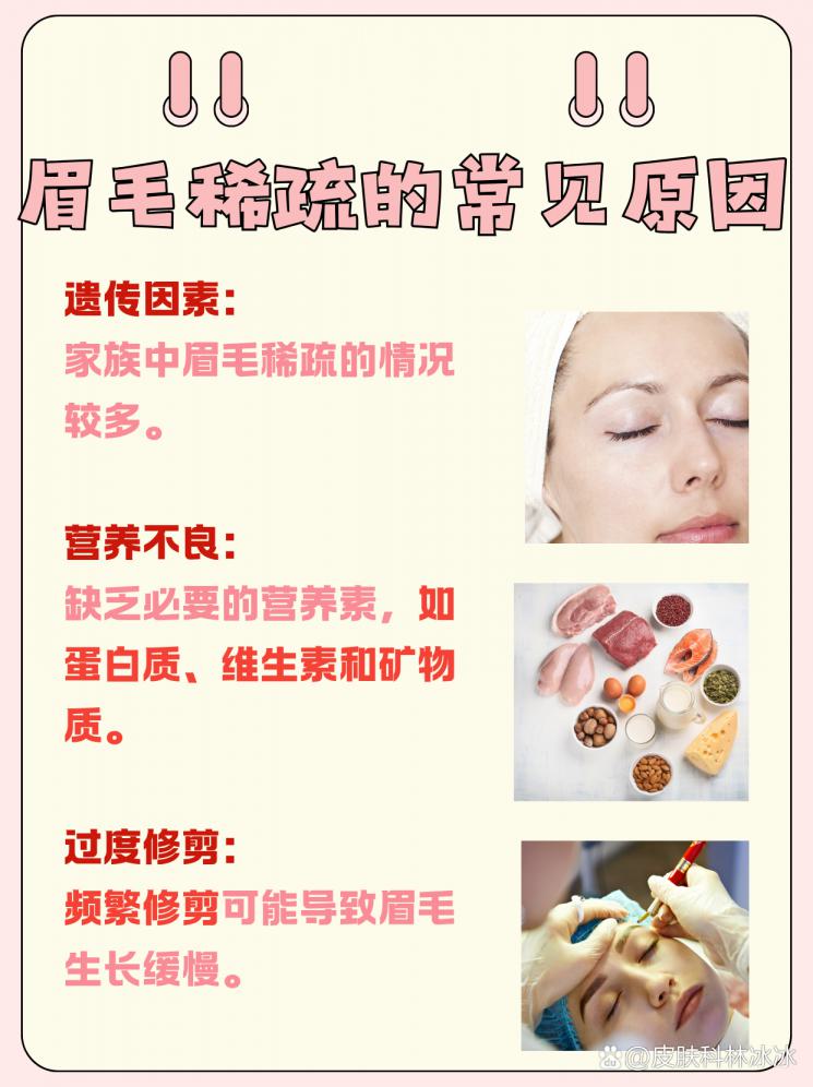 拯救稀疏眉尾：揭秘眉毛生长的秘密