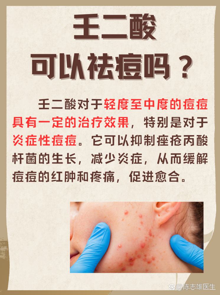 壬二酸，真的能帮你战“痘”到底吗？
