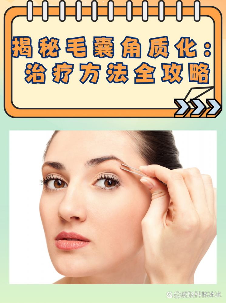 揭秘毛囊角质化：治疗方法全攻略