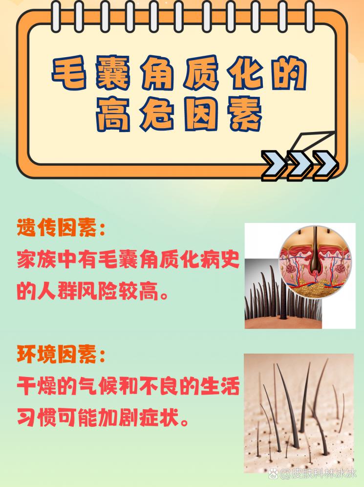 揭秘毛囊角质化：治疗方法全攻略