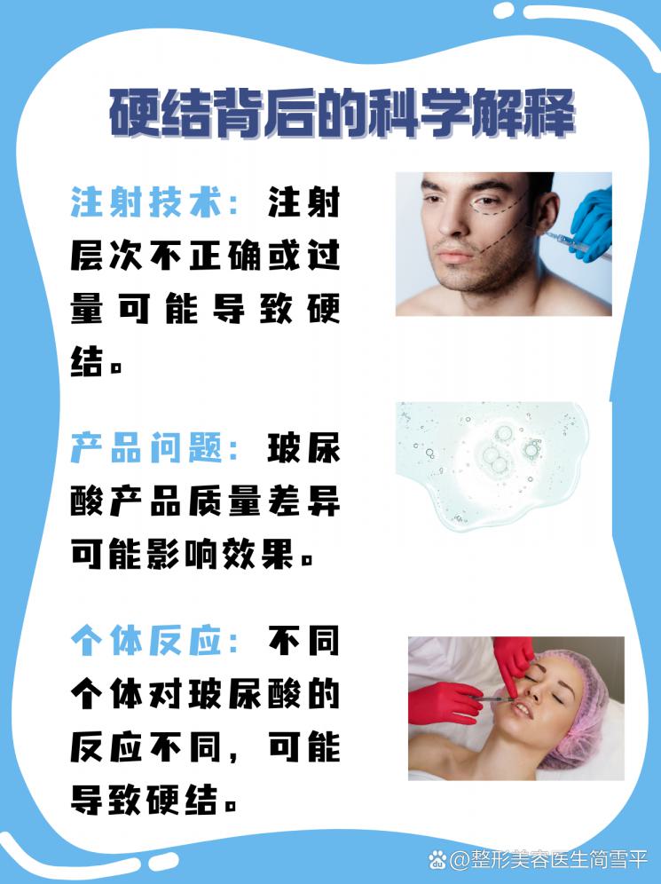 玻尿酸硬结不必慌，专业指导来帮忙