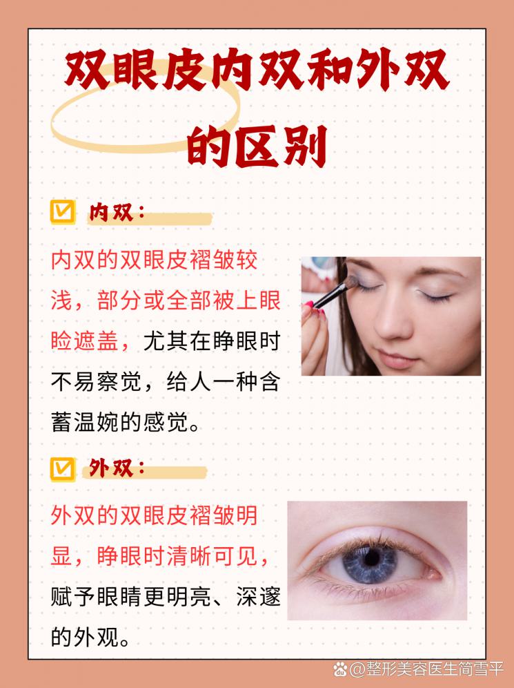 双眼皮内双与外双：揭秘两者之间的差异！