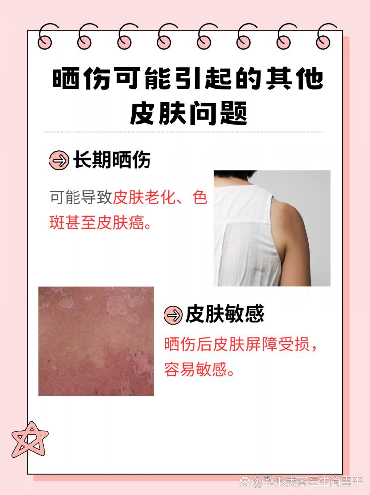 晒后修复指南：肌肤重生秘籍