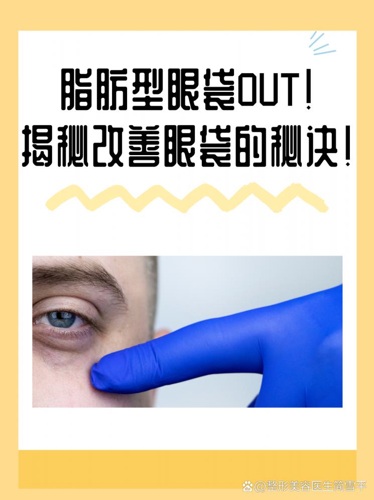 脂肪型眼袋OUT！揭秘改善眼袋的秘诀！