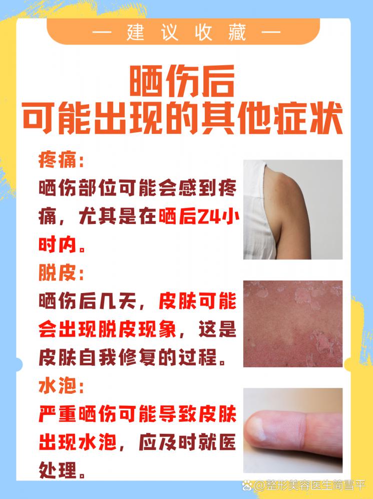 晒伤发红不用慌，修复攻略来了！
