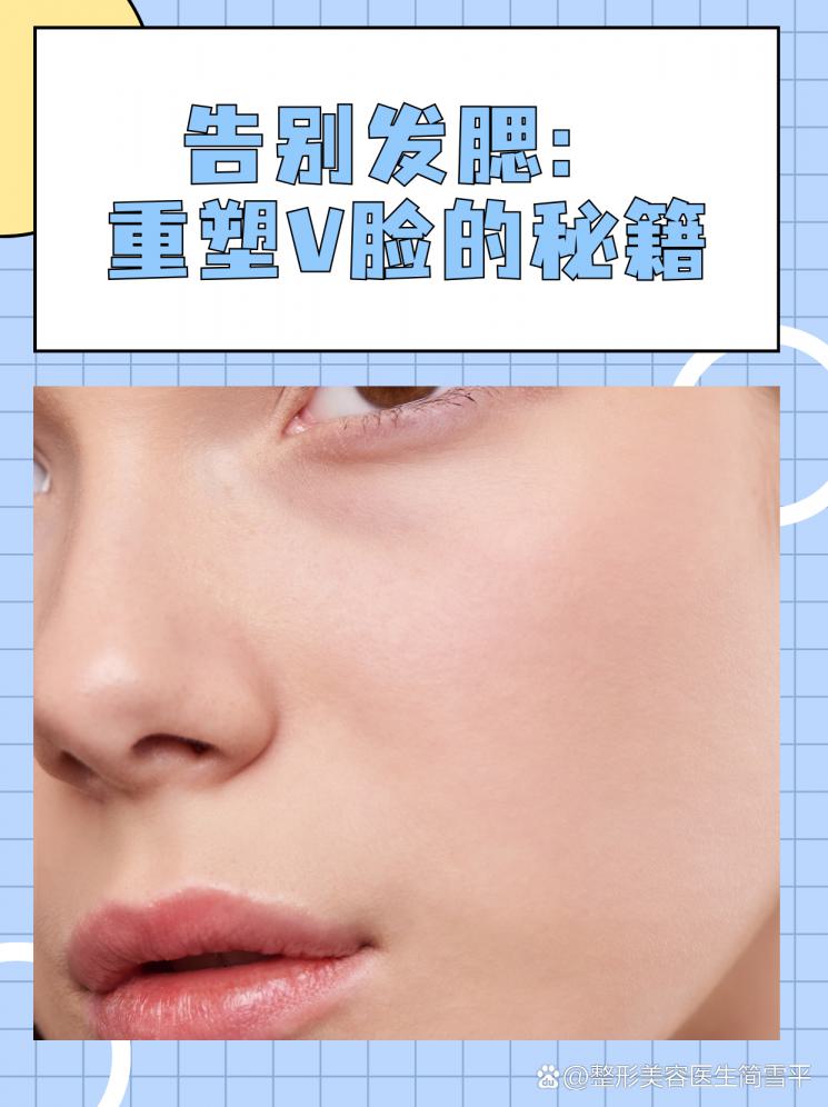 告别发腮：重塑V脸的秘籍