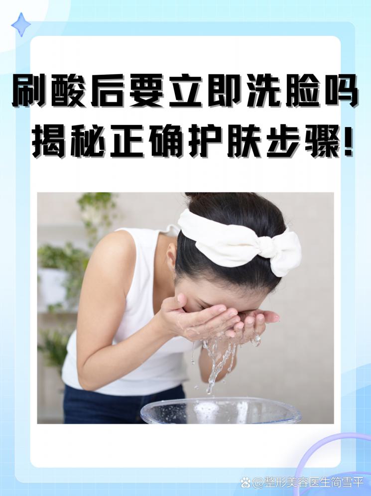 刷酸后要立即洗脸吗？揭秘正确护肤步骤！
