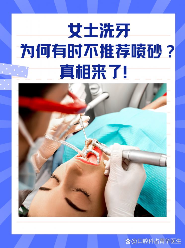 女士洗牙为何有时不推荐喷砂？真相来了！