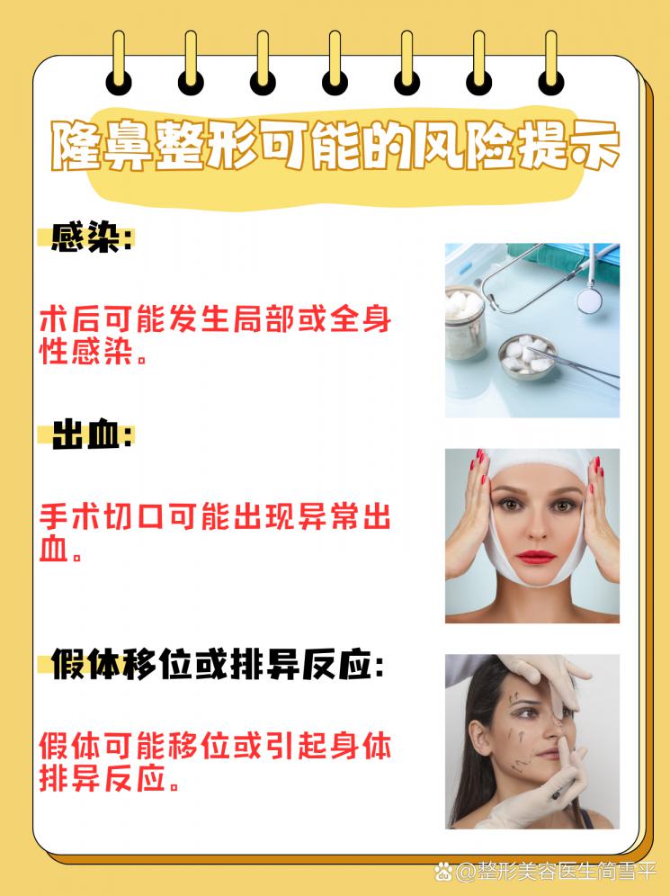 隆鼻整形：塑造完美鼻型的科学指南
