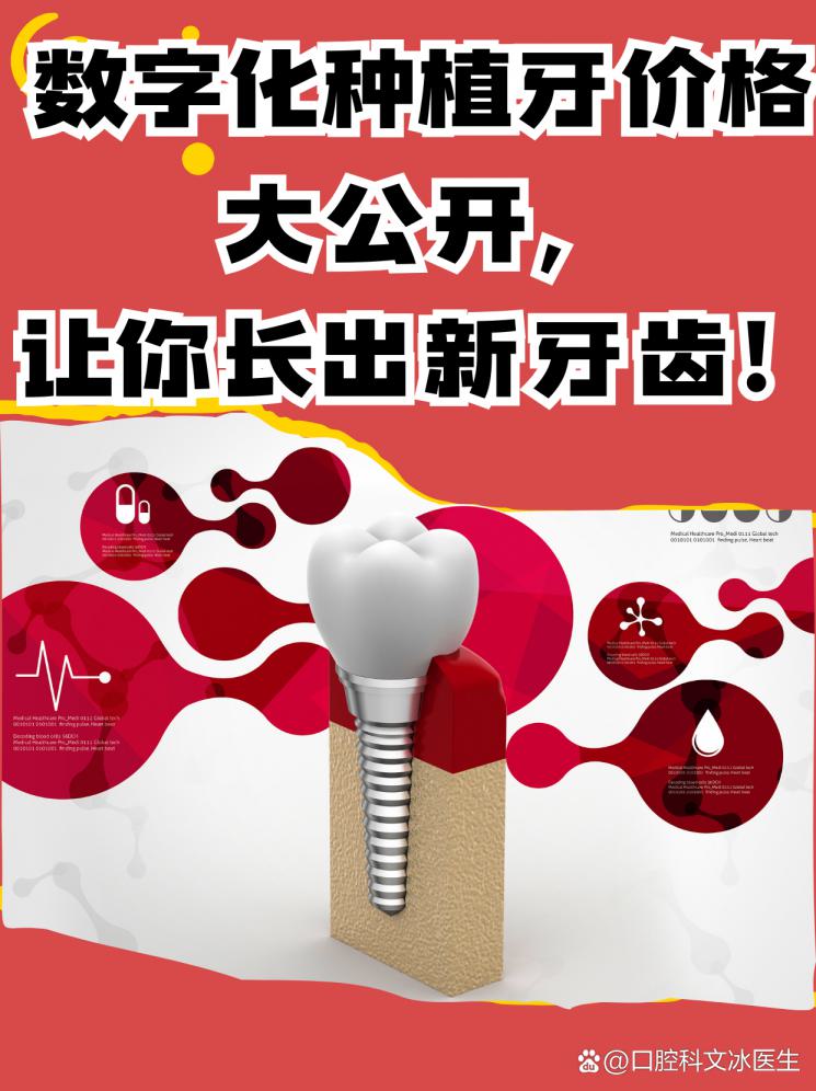 数字化种植牙价格大公开，让你长出新牙齿！