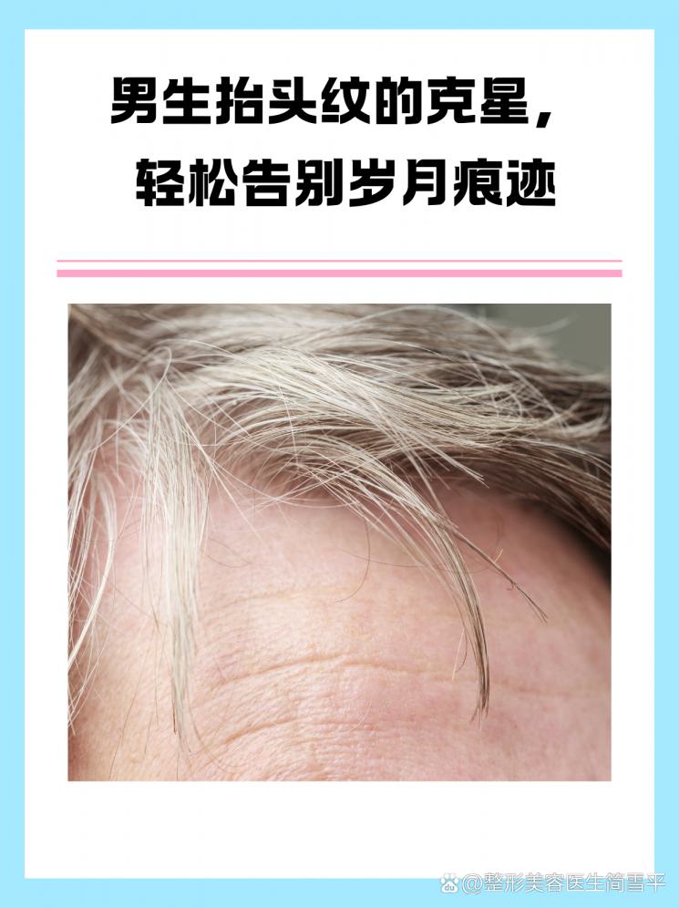 男生抬头纹的克星，轻松告别岁月痕迹