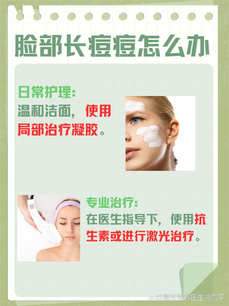 战痘速决：快速击退脸部痘痘