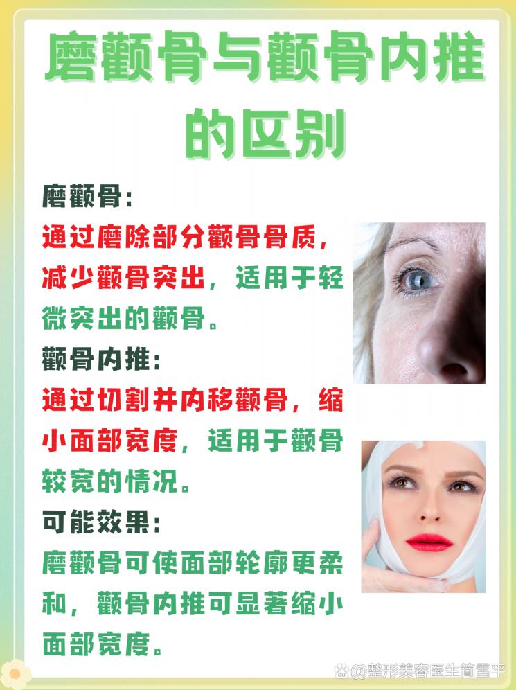 揭秘磨颧骨与内推：美丽轮廓的秘密