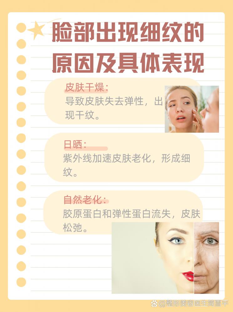 抗击岁月痕迹：脸部细纹全攻略