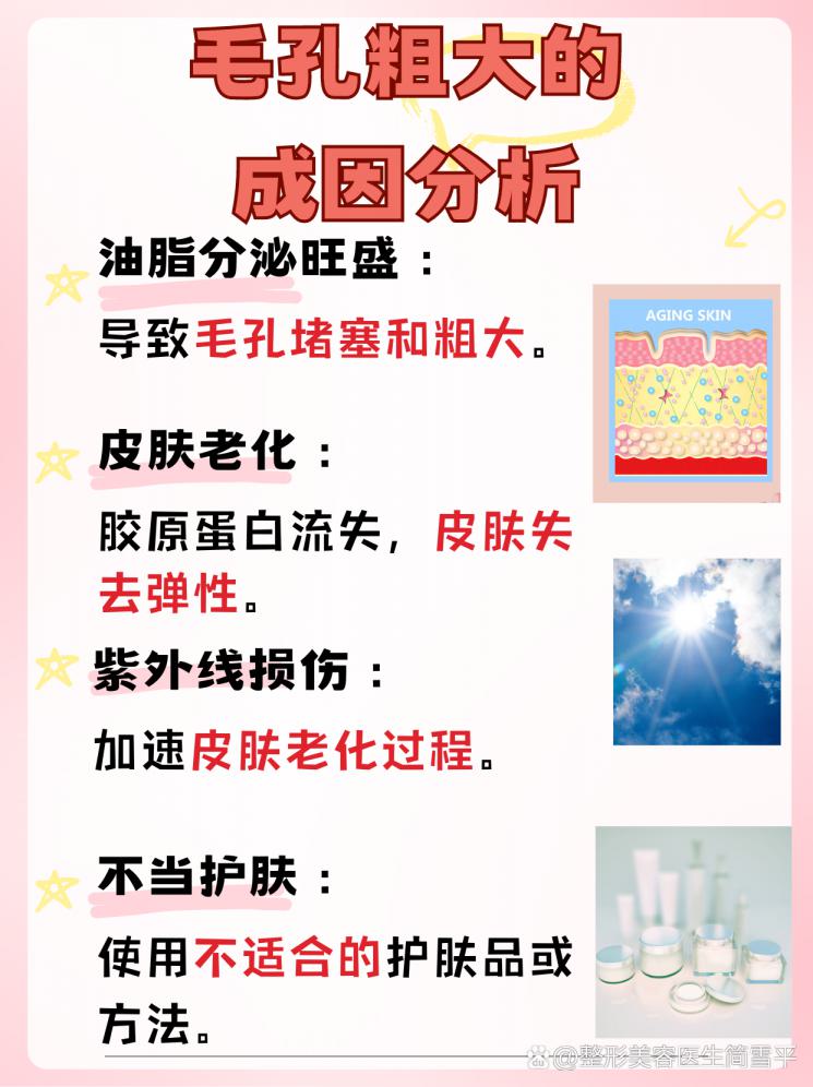 毛孔粗大？揭秘美容项目选择指南
