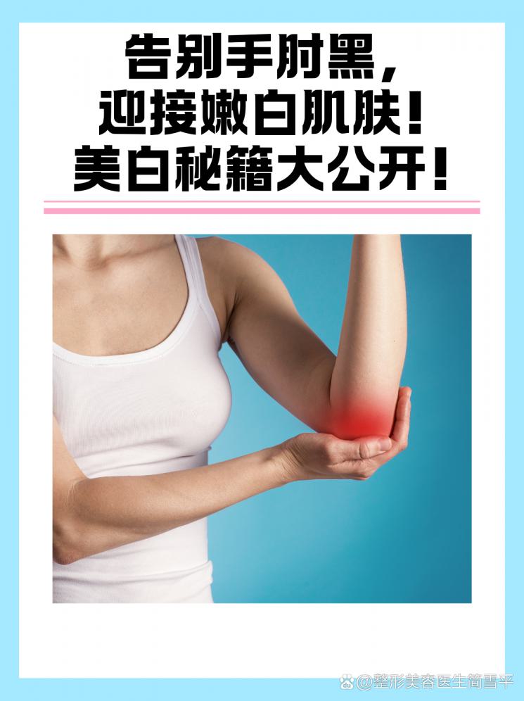 告别手肘黑，迎接嫩白肌肤！美白秘籍大公开！